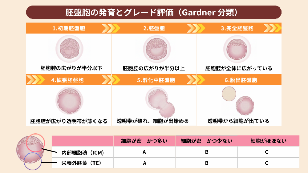 ガードナー分類